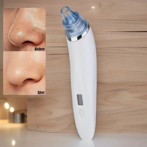 Beauty Pore Vacuum